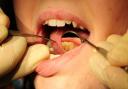 Plans to improve dental provision are welcomed