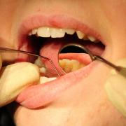Plans to improve dental provision are welcomed